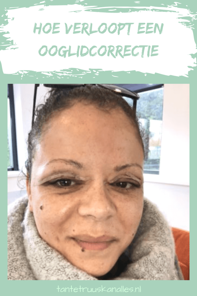 Hoe ik mijn ooglidcorrectie heb ervaren